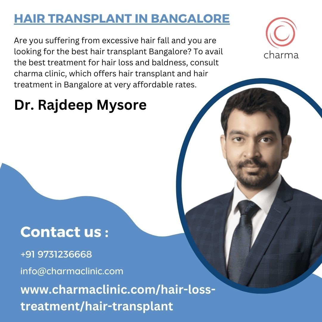 Avail the Benefits of Hair Transplant in Bangalore at Charma Clinic